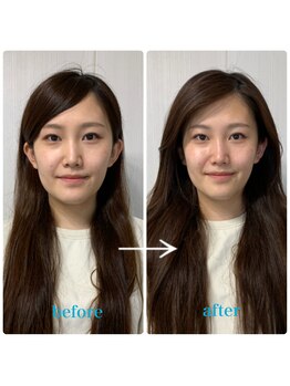 ラリマール/お客様のビフォーアフター