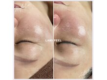 リラクゼーションアンドビューティーボヌール(BONHENR)/最新☆ラミネーションピール