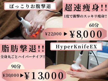 チュラの写真
