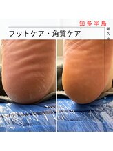 ピーアンドオー(P&O)/