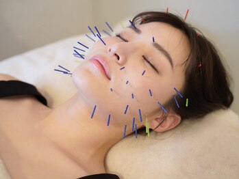 ストリ(STRI)/今SNSで話題の美容鍼施術！