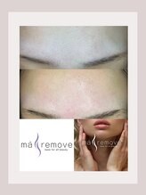 ラフィーユ うるま店(Lafille)/フェイシャルWax