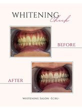 エクリュ(Ecru)/Before→After