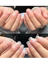 リミズネイルビューティー 名駅店(RimisNailxbeauty)/深爪・噛み爪改善