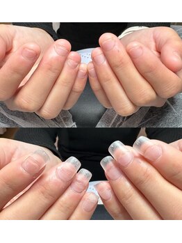 リミズネイルビューティー 名駅店(RimisNailxbeauty)/深爪・噛み爪改善