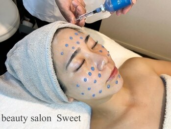 スウィート 矢場町店(Sweet)の写真/【トロイピールで根本改善】毛穴詰まりや黒ずみ,ざらつきの原因となる角質を整え,なめらかな毛穴レス肌へ。