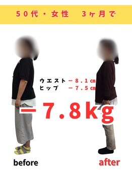 佐々木整骨院/ダイエット終了【50代女性】