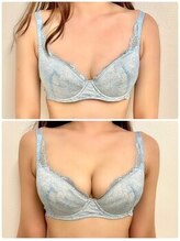 美人バスト 新潟店/ 【バストアップ★育乳】症例