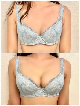 美人バスト 新潟店/ 【バストアップ★育乳】症例