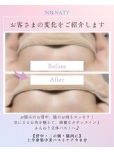 ソルナティ 伊勢原(SOLNATY)/上半身のお悩みに◎