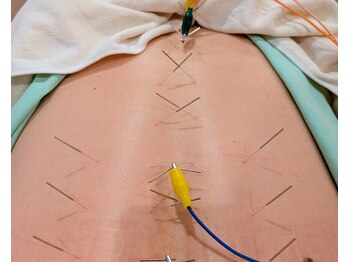 まるはりきゅう治療院の写真/ストレスや睡眠不足、目の疲れなど「何となく不調」を感じる方に。鍼灸が初めての方にもオススメ◎
