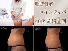 エルール トータルビューティ(Aileure total beauty)