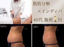 エルール トータルビューティ(Aileure total beauty)