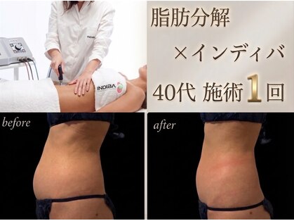エルール トータルビューティ(Aileure total beauty)の写真