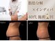 エルール トータルビューティ(Aileure total beauty)の写真