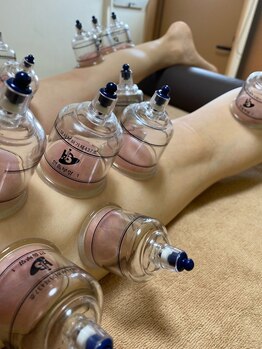 トトン(toton)/カッピング(吸い玉)