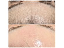 オミンゴ(omingo)の雰囲気（フェイシャルwaxでツヤツヤ！肌のトーンもup☆）