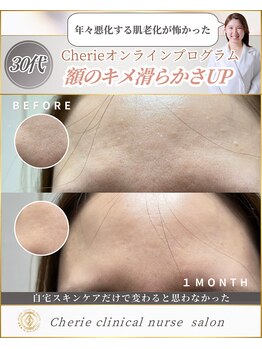 シェリー(Cherie)/来店なし！毛穴開き収縮透明感UP