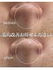 セリー(Celie)の写真/【本気の肌質改善】もう毛穴に悩まない。プロの分析×オーダーメイド施術で、根本から変わる喜びを実感