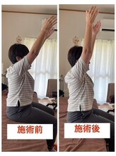 にこ。/整体による姿勢の変化