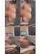 カム(KAMU)の写真/離れ乳や下垂をケアして、露出が多い夏に自信！メリハリボディと美胸へ♪