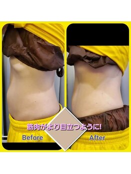 ミミーモリオカ(MiMiy MORIOKA)/APTS施術後