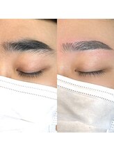 ミリヘレン(MILLI HELEN)/劇的ビフォーアフター★