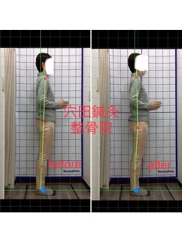 穴田鍼灸整骨院/整体・骨盤・ねこぜ・まき肩矯正