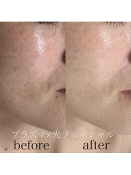 アンドエス(&S.)/R7年春新フェイシャルメニュー☆