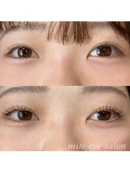 ミテ(mite)/6週間でまつ毛パーマがオススメ