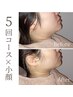 【お得★人気No.1小顔脂肪分解5回で32,500円】毎回選べるオプション付き☆
