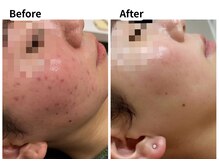 ムーロ バイ ミュー(muro. by mieux)/Before After