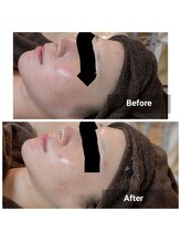 リノリー 一関店(rinory)/公式ライン移転記念キャンペーン