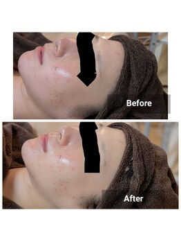 リノリー 一関店(rinory)/公式ライン移転記念キャンペーン