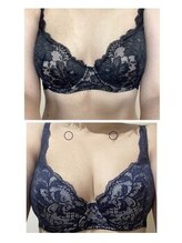 美人バスト 新潟店/ 【バストアップ★育乳】症例