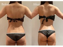 シューラディアント(ShuRadiant)の雰囲気（ブライダルに向けたボディケアも得意です）