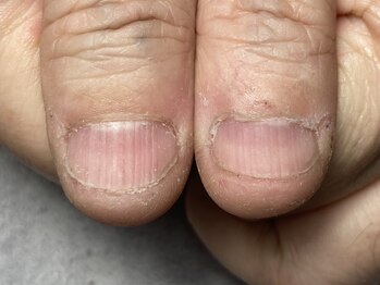 結(Yui)の写真/経験と技術で導く、自信の持てる自爪へ♪-爪のコンプレックスを自信に変える技術-