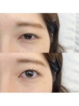 フランセス(Frances)/ラッシュリフト