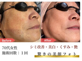 トレース/美顔フォトの効果