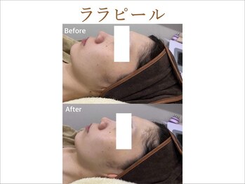 ティアム バイ テトテ 神戸三宮(TIAM by tetote)/ララピール