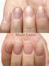 マリーロール 淀屋橋本店(Marie Laure)/自爪育成/深爪矯正/ネイルケア