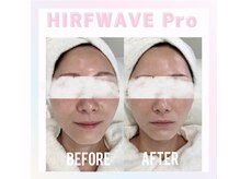 ウナ デ リンゴル 恵比寿店(UNA de Ringol)/最近マシンビフォーアフター