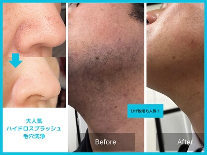 ロココ(LOCOCO)の写真
