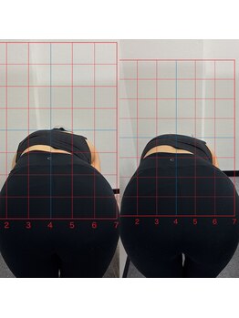 ハーモニーフィットネス 赤坂(Harmony Fitness)/背骨の歪み矯正