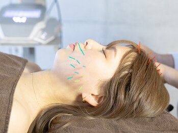 ラムールボーテ(L'AMOUR BEAUTE)/オーダーメイド美容鍼