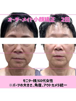 リマ(LIMA)の写真/【加齢のせいと諦めないで★】お顔の歪み/浮腫み/たるみ/しわ/くすみ/面長/エラ張/首肩こり・頭痛にも◎