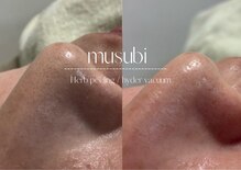 ムスビ(Musubi)