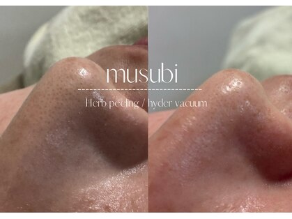 ムスビ(Musubi)の写真