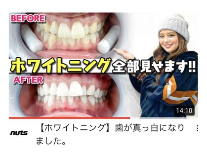 【歯のホワイトニング専門店】WhiteningBAR 金沢フォーラス店 【ホワイトニングバー】