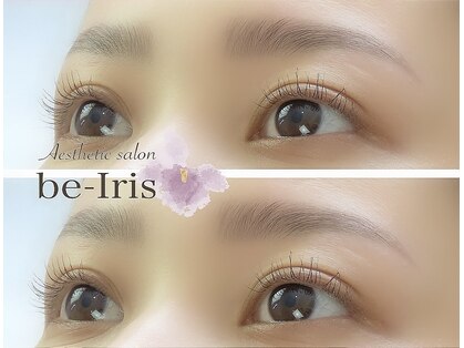 ビーアイリス(be-Iris)の写真